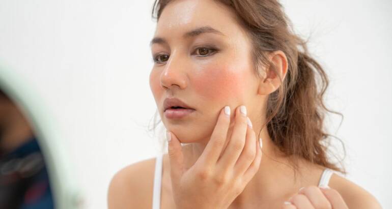 Silent Saboteurs of Your Health: Pests Cause Allergy